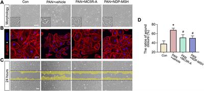 Pharmacological Melanocortin 5 Receptor Activation Attenuates Glomerular Injury and Proteinuria in Rats With Puromycin Aminonucleoside Nephrosis